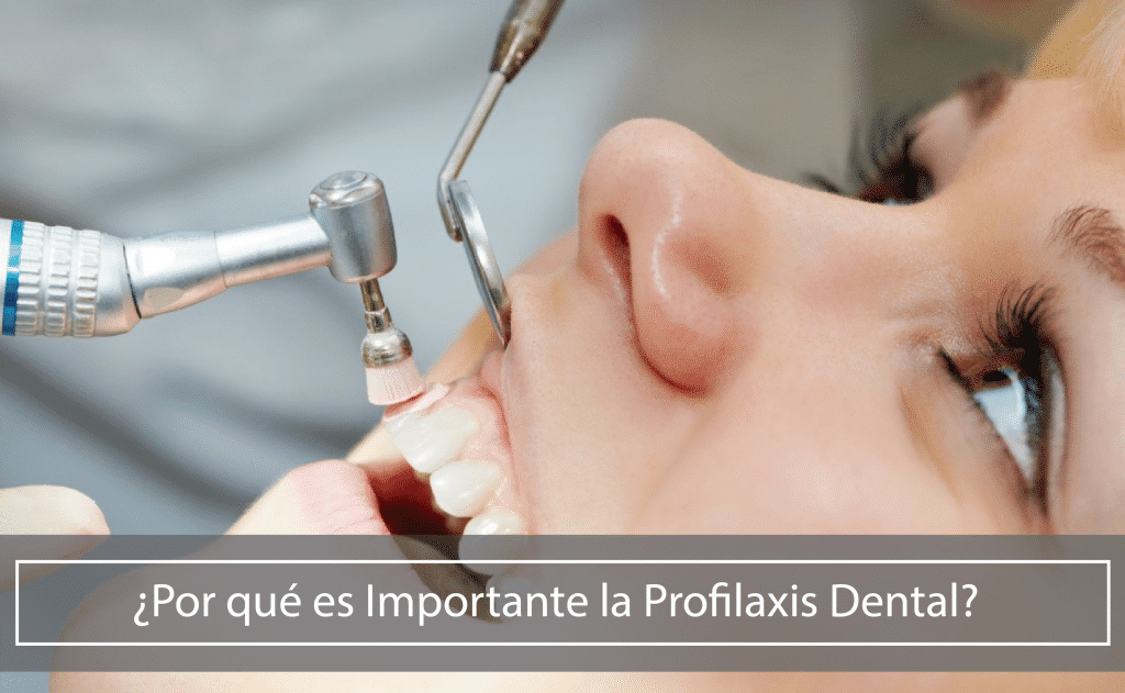 Profilaxis Dental