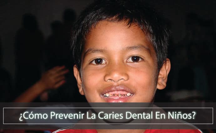 ¿Cómo prevenir la caries dental en niños ? | Dentilandia Medellín