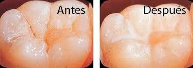 Odontopediatría Correctiva