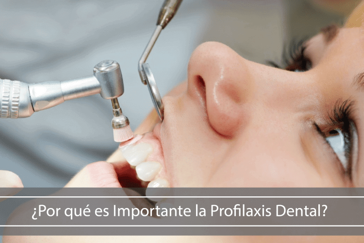 Profilaxis Dental